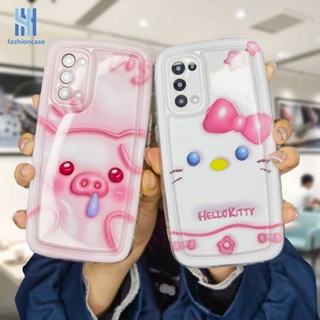 เคสโทรศัพท์มือถือแบบนิ่ม TPU กันกระแทก ลายเฮลโลคิตตีน่ารัก สําหรับ Realme C21Y C30 C30S C31 C33 C35 C11 2021 C15 C21 C25 C20 C3 C12