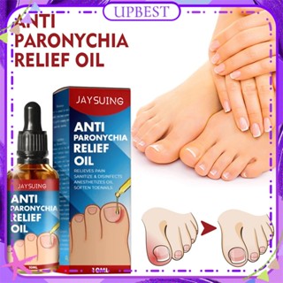 ♕ Jaysuing Anti Paronychia Relief Oil Repair Embedded Nail Thickening Grey Nail Relief Pain Ditch Soothing Care Oil Body Nail Care 10ml สูงสุด