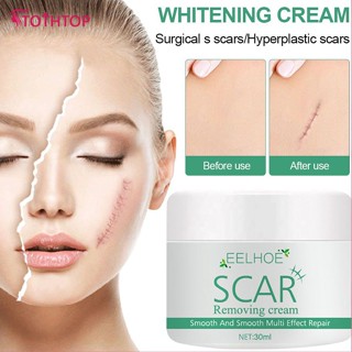 Eelhoe Scar Removal Cream ครีมซ่อมแซมแผลเป็นจากสิว สิวเสี้ยน รอยแตกลาย แผลไหม้จางลง ส่งเสริมการสร้างเซลล์ใหม่ เพิ่มความชุ่มชื้น Smoothing Repair Gel [TOP]