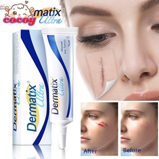 cocoy Dermatix Acne Scar 5 G Dermatix Acne Scar เจลซิลิโคนที่ดีที่สุดสำหรับแผลเป็นจากสิว