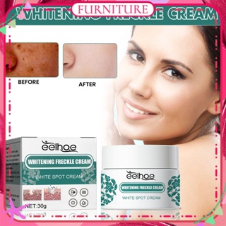 ♕ Eelhoe Whitening Freckle Cream Remove Chloasma Acne Spot Pigment Face Cream Anti-wrinkle Brightening Moisturizing Non Greasy Facial Skin Face Care 30g FURNITURE