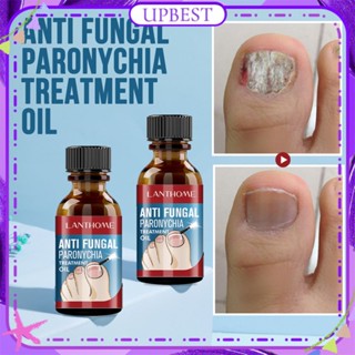 ♕Lanthome Anti Fungal Paronychia Treatment Oil Repair Onychomycosis Toe เปลี่ยนสีแบคทีเรีย Anti Gentle Care Solution Nail Care 10Ml UPBEST