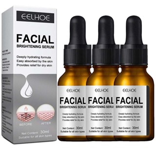  3PCS/30ml EELHOE Facial Brightening essence Moisturizing&amp;Moisturizing Lotion Brightens Skin Color and Fades Stains