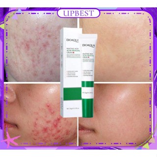 ♕Bioaoua Salicylic Acid Acne Removal Cream ลบผิวสิวหัวดำ Acne Moisturizing Hydrating Acne Marks Whitening Face Care 20G UPBEST