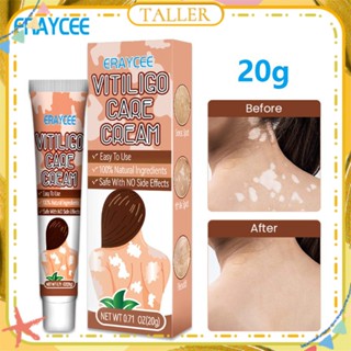 ✧Ready Stcok Eraycee Vitiligo Care Cream Removal White Spot Sweat Spot Adjust Skin Color Ointment Moisturizing Skin Natural Ingredient Treatment Body Care TALLER