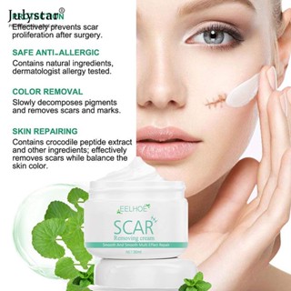 JULYSTAR Eelhoe Plant Scar Repair Cream Acne Scar Stretch Mark Remover For Burn Scars เก่าหลังการผ่าตัด