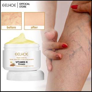 EELHOE Vitamin K Cream Strong Skin Hydrating Moisturizing Brightening Facial Women Beauty Care Cream-Eelhoe