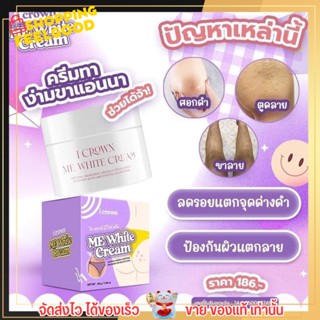 สุดฮิต!! ครีมทาง่ามขา แอนนา I CROWN ME WHITE CREAM ครีมทาจุดซ้อนเร้น รักแร้ ขาหนีบ ข้อศอก หัวเข่า ที่ดำด้าน ศอก