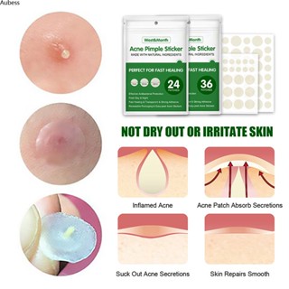 Ready West Month Acne Pimple Patch Waterproof Stickers 24/36pcs Concealer Invisible Ibreathable Painless Skin Care Face Spot Treatment Remover Tool Serein ซื้อทันที เพิ่มลงในรถเข็น