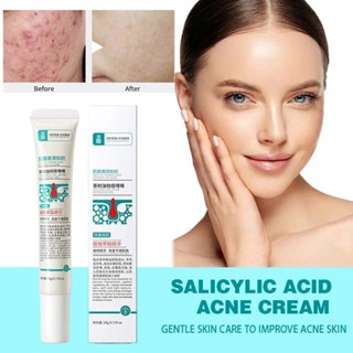 2X Salicylic Acid Acne Lightening Cream Tea Tree Oil Warming and Soothing Care