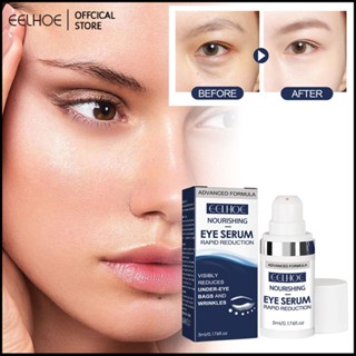 EELHOE Eye Repair Essence ให้ความชุ่มชื้นและให้ความชุ่มชื่นแก่ผิวรอบดวงตาเพื่อขจัดความหมองคล้ำซ่อมแซมผิวกระชับและปรับผิวให้เรียบเนียน -eelhoe