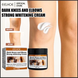 eelhoe Joint Black Whitening Cream Skin Brightening Skin Tone Cream Wrist Whitening Moisturizing Skin Cream -eelhoe