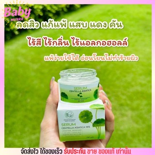 เซรั่มใบบัวบก พรทิน่า ว่านหางจระเข้ PONTINA skincare ฟื้นฟูผิวแพ้ครีม ผิวไหม้แดด สิว