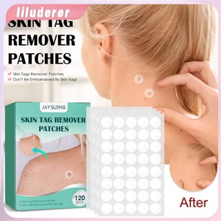 120 ชิ้น/กล่อง Warts Remover Patch ปลอดภัยไม่เจ็บปวดแท็ก Patches Pimple Wart Treatment Patch Fast Acting Remover หูด Moles HO