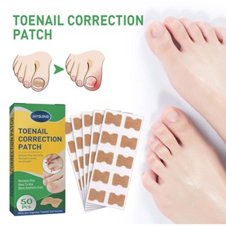 50pcs Jaysuing Toe Nail Groove Correction Stickers  Ingrown Nail Pull Repair Manicure toenail correction patch Correction Pull Sticker Manicure