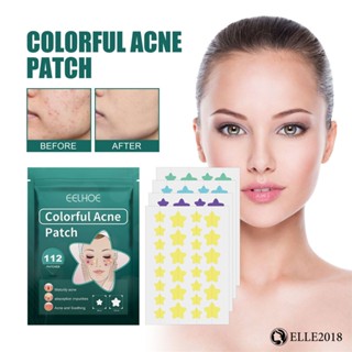 EELHOE 112 Patches Star Pimple Patch Invisible Natural Breathable Non-suffy -covering Scars Anti-bacterial Patch 【elle20181_th】