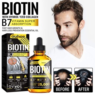 Biotin &amp; Hydrolyzed น้ํามันหอมระเหยคอลลาเจนปลูกผม สําหรับผู้หญิงและผู้ชาย