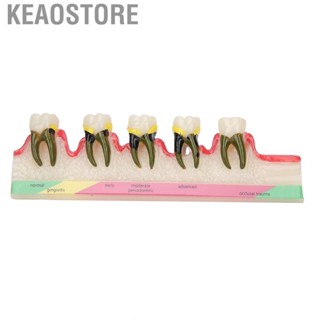 Keaostore Dental Model  Study Decoration Professional Demonstration Learning