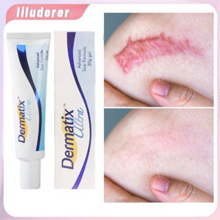 Dermatix ครีมลบรอยแผลเป็นที่มีประสิทธิภาพ Scar Gel Old Scars Acne Scars Treatment HO