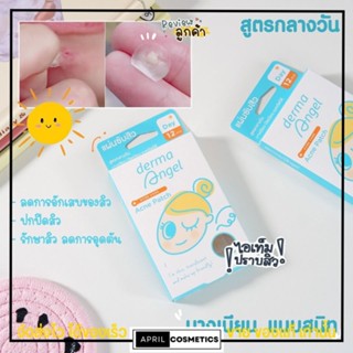 แผ่นแปะสิว 18 ชิ้น! สูตรกลางวัน สิวยุบ ปกปิด แต่งหน้าทับได้ ดูดสิว แปะสิว ลดรอย DERMA ANGEL Acne Patch Day