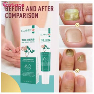 ครีมซ่อมแซมเล็บ Elaimei ครีมบำรุงเล็บ Onychomycosis Nail Repair Treatment 15g Quick Fix Nail [TOP]