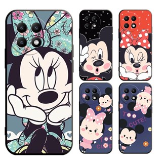 เคสนิ่ม OnePlus Nord 100 Nord CE 3 CE 2 2lite 1+11 1+10 Pro 1+10T