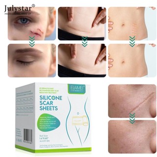 JULYSTAR Elaimei แผลเป็นขนาดเล็ก Self-adhesive Scar Removal Sticker Stretch Marks Sscald Caesarean Section Scar Sticker