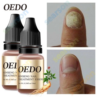 OEDO Herbal Antibacterial Nail Treatments Fungus Removal Essential Herbal Extract Nail Fungus Repair Essence 【searson】 【searson】 【searson】