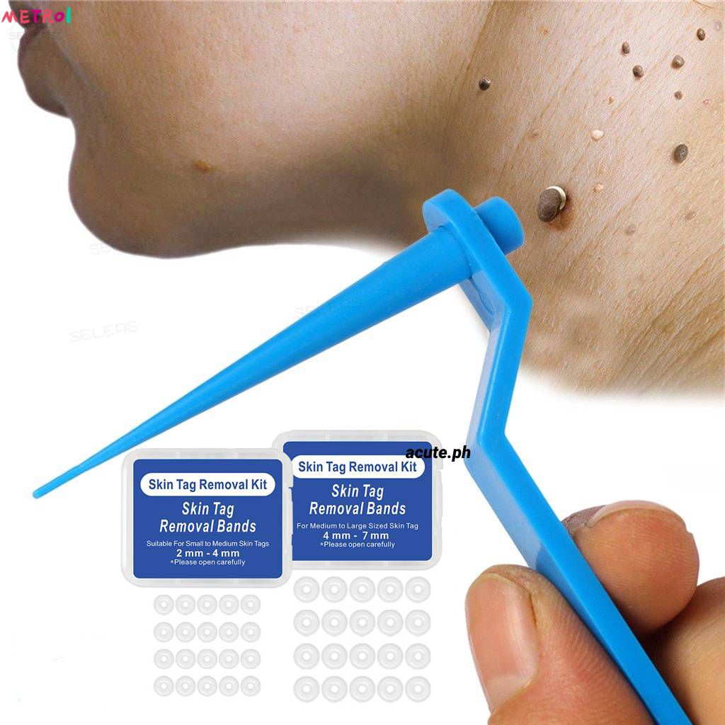 Elaimei Skin Tag Kill Skin Mole Wart Remover Band, 2-in-1 Skin Tag Removal Kit, With Cleansing Pads,