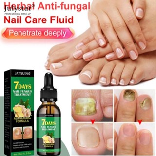 JULYSTAR Jaysuing 30ml Nail Fungus Nail Nourishing Serum Nail Healing, Essence, บำรุงเล็บ, บำรุงเล็บ