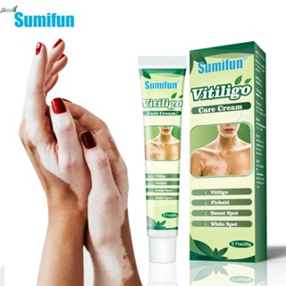 Sumifun White Spot Cream Vitiligo Care Skin External Health Repair Cream K10046 qccuot