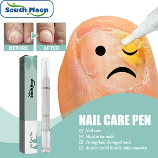 Spot second hair# South moon nail repair pen nail dead skin acne onychomycosis care nutrition moisturizing repair pen 8cc