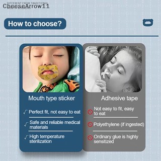Che สติกเกอร์เทปแปะปาก ป้องกันปาก หายใจสะดวก สําหรับเด็ก 30 ชิ้น ต่อกล่อง