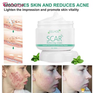 Eelhoe Scar Repair Cream Dilutes Burns Old Scars Postoperative Scars Skin Smoothing Repair Cream [TOP]