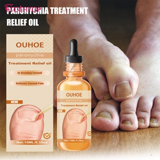 Ouhoe Paronychia Treatment Relief Oil Onychomycosis Repair Serum Repair คุด Toenails Anti-infective Yellowing Cracking Growth Nail Fungal Removal Oil [TOP]