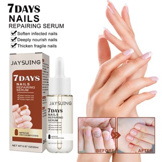 in stock#Jaysuing 7-day Nail Repair essence repair cauldron thickened gray nail hand and foot nail repair solution 7/10