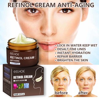 Retinol ครีมบํารุงผิวหน้า ต่อต้านริ้วรอย กระชับผิว