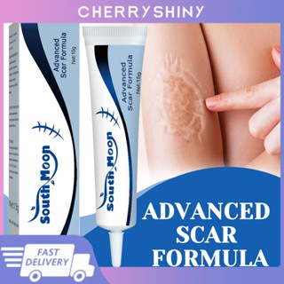 Fade Scar Stretch Marks Remover Cream ครีมกำจัดรอยแผลเป็นอย่างมีประสิทธิภาพ Scar Gel แผลเก่า การรักษาแผลเป็น