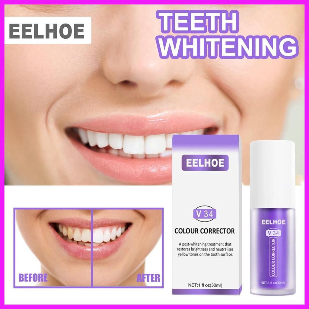 Smilekit ALIVER Eelhoe Hismile ยาสีฟันไวท์เทนนิ่ง V34 สี