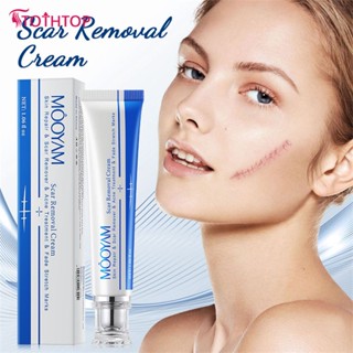 Mooyam Scar Moisturizing Repair Treatment Treatment Surgical Scar Stretch Marks Acne Pox Print Repair Cream [บนสุด]