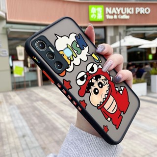 เคสซิลิโคนใส ขอบสี่เหลี่ยม ลายการ์ตูนชินจัง กันกระแทก สําหรับ Infinix Hot 12 Play Hot 12i Hot 10i Hot 11 2022