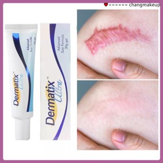 Dermatix 15g Scar Cream Ointment Repair Postoperative Scar Ointment Times Shu Scar Silicone Gel Effect ช่วยลดรอยแตกลายอย่างมีนัยสำคัญ Hydrating Moisturizing cod