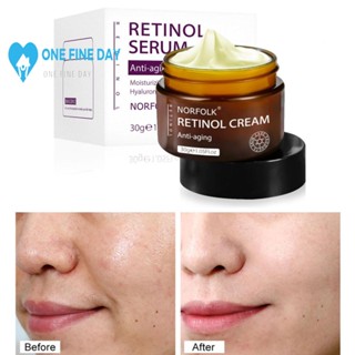 Retinol ครีมคอลลาเจนต่อต้านริ้วรอย ไวท์เทนนิ่งเอสเซ้น บํารุงผิว ต่อต้านริ้วรอย 30 กรัม T2G6