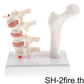 ชุดโมเดลกระดูกสันหลังส่วนต้นขา กระดูกพรุน 11 ชิ้น 1/2/3 ทนทาน