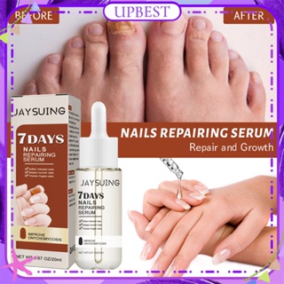 ♕Jaysuing 7วัน Nail Repair Essence Element Repair คุดเล็บหนาสีเทาเล็บ Anti Fungi Treatment Liquid Body Nail Care 20Ml UPBEST