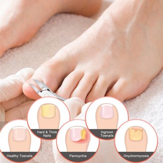 Lily PERS Podiatrist Toenail Clippers Professional Thick Ingrown Toe Nail Clipper Pedicure Cutter Curved Grooming Tool