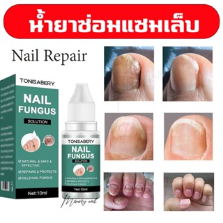 ( TO-01 เขียว 10ml ) ฆ่าเชื้อราที่เล็บ เซรั่มบำรุงเล็บ ยาเชื้อราเล็บ ซรั่มรักษาเล็บ เชื้อราเล็บ ครีมบำรุงเล็บ ฆ่าเชื้...