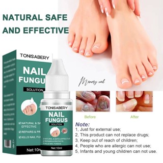 ( TO-01 เขียว 10ml ) ฆ่าเชื้อราที่เล็บ กำจัดเชื้อรา Kills Nail Fungus Removal Set Cream Liquid Onychomycosis Repair N...