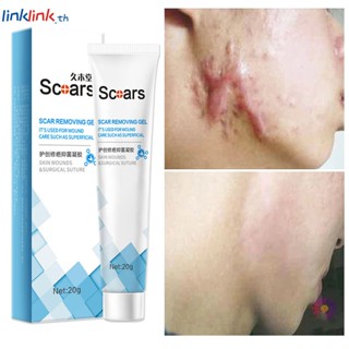 Jiumutang Scar Remover ครีมแต้มสิว 20g Scar Gel Cream Stretch Marks Acne Scar Pimples Marks Burn Scar Caesarean Section Scar Surgery Scar Remover Marks For Face Skin Care Linklink