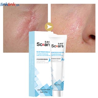 Jiumutang Scar Remover Gel Cream 20g ลบรอยแผลเป็นจากสิว รอยแตกลาย ซ่อมแซมและแผลเป็นนูนหนัก แผลเป็น แผลเป็น การผ่าตัดแผลเป็น Scar Linklink